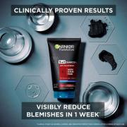 Garnier Pure Active Intensive 3 in 1 Anti-Blackhead Charcoal Wash, Scrub and Mask 150 ml