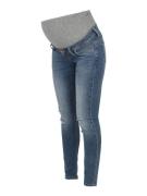 Only Maternity Jeans 'Coral'  blue denim